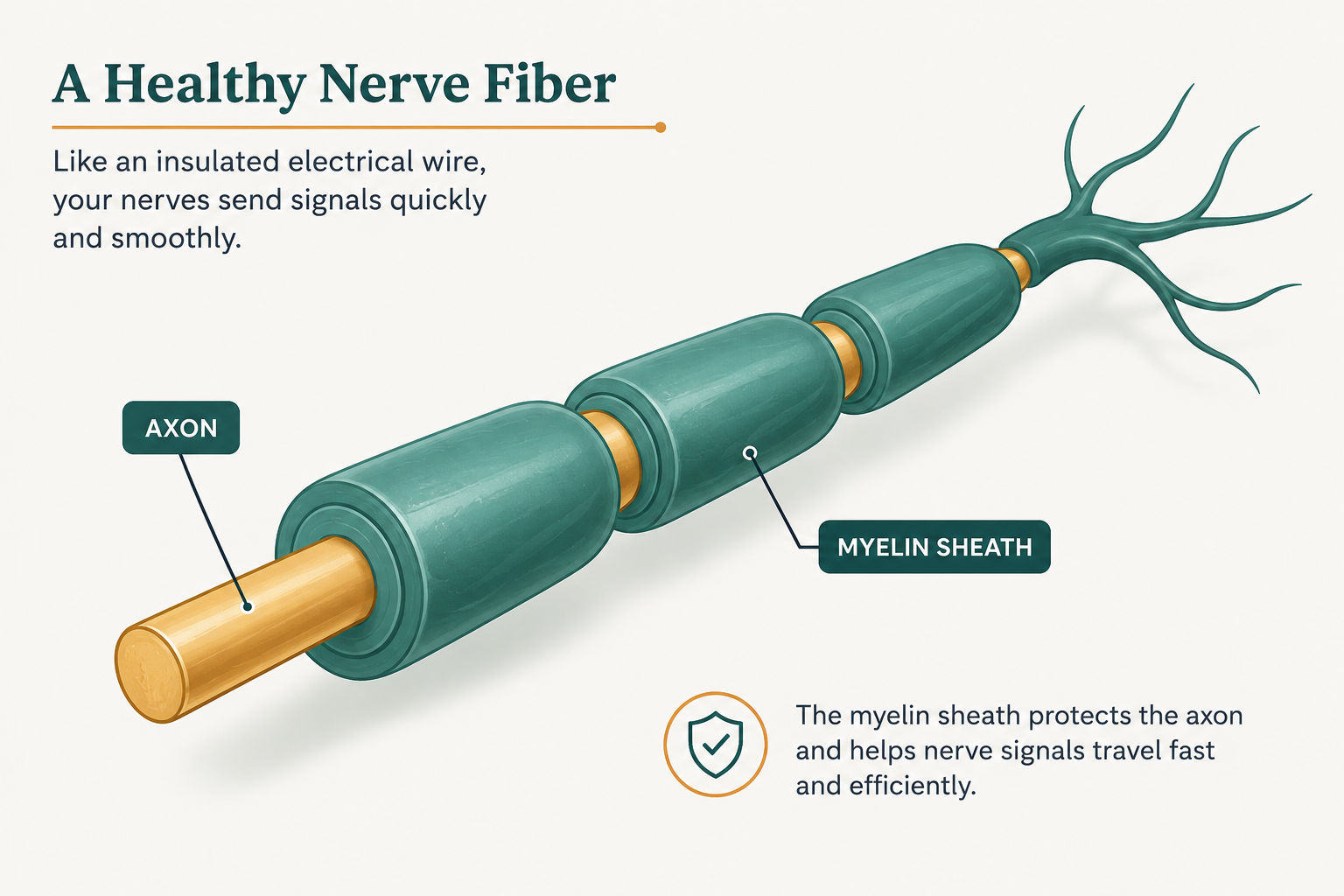 Diagram of a peripheral nerve and its protective myelin sheath, the cause of neuropathy symptoms.