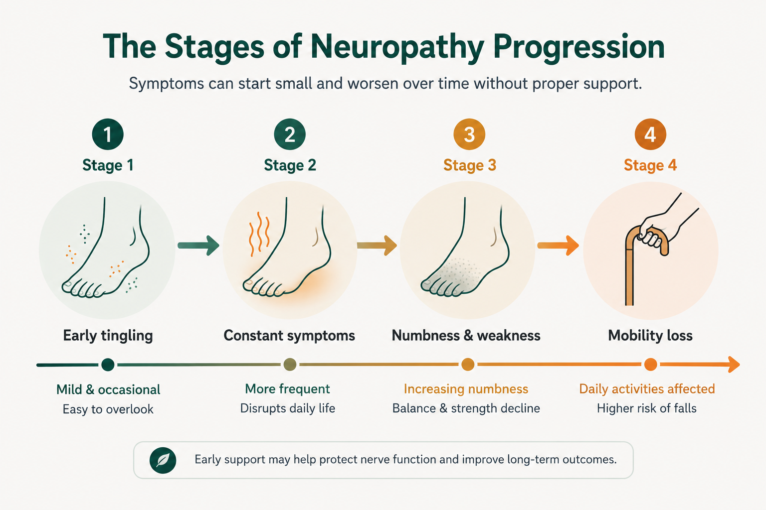 The four stages of peripheral neuropathy progression in the feet.