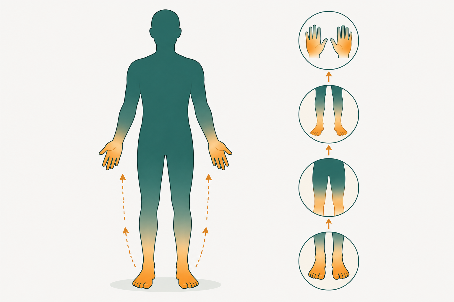 Body map showing how peripheral neuropathy symptoms progress from the toes upward.